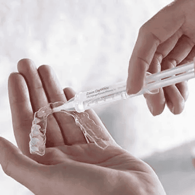 Home-Bleaching – Flexible Anwendung für Zuhause