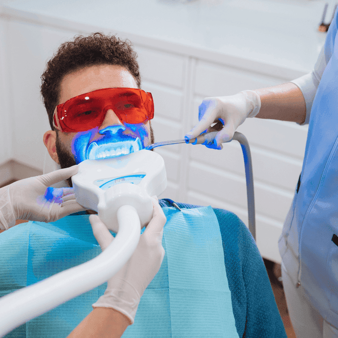 In-Office-Bleaching – Sofortige Aufhellung in der Praxis
