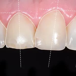 Digital Smile Design in Bern und Köniz: Ihr neues Lächeln vorab erleben