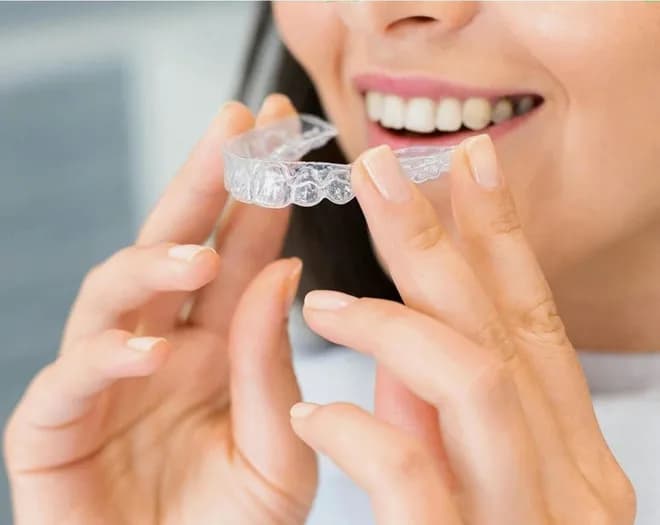 Invisalign in Bern und Köniz – die unsichtbare Zahnkorrektur