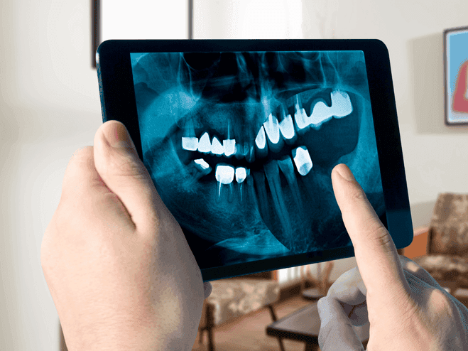 Oralchirurgie in Bern und Köniz