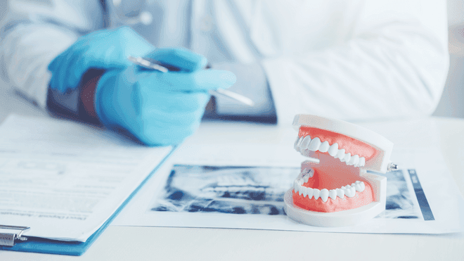 Komplexe Zahnextraktionen in Bern und Köniz